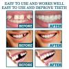 Veenora Clip on Veneers, Minceetbien Dentures, Snap On Veneers Silicone Kit for Both Upper and Lower, Silicone Reline Denture Set (3Set) view 4