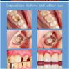 2025 New Probiotic Toothpaste,Deep Cleans Gums,Tooth Whitening Toothpaste,Quick Removal Tone Teeth,Brightening Tooth Fresh Breath view 3