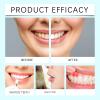 Niacinamide Whitening Toothpaste, Radiant Whitening Toothpaste,100g Nicotinamide Teeth Whitenings Powder, Niacinamide Toothpowder, Stain Removal Natural, Intensive Stain Removal & Complete Care (1) view 3