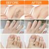 Barebliss Facial Hair Removal Cream, Hormonal Facial Hair Remover Serum, Painless Hai Removal Cream, Gentle and Non-Irritating Effective, Delayed Growth for All Skin Types (1) view 3