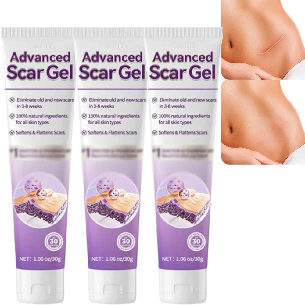 Advanced Scars Gel, Keloids Bump Removals, Scars Creams, Scar Removal Creams, Keloid Removal Cream, Keloid Bump Treatment, Scar Cream For Surgical Scars (3)