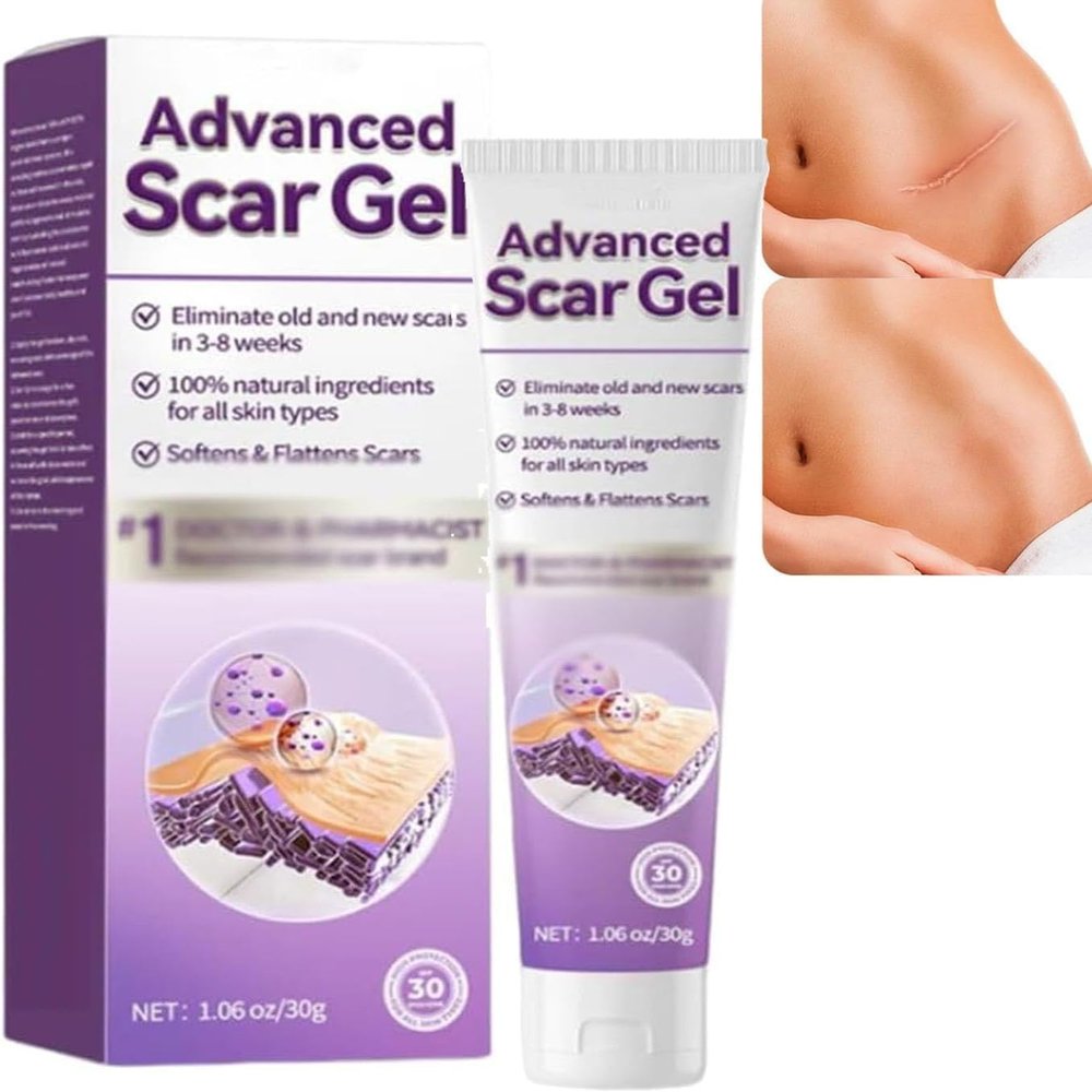 Advanced Scars Gel, Keloids Bump Removals, Scars Creams, Scar Removal Creams, Keloid Removal Cream, Keloid Bump Treatment, Scar Cream For Surgical Scars (1)