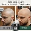 Scalp Care Cream, Balds Cream, Moisturizing Nourishing & Scalp Care, Suitable For Balds Men, Men's Shaving Creams With Matte Effect (50g, 3pcs) view 2