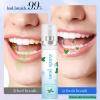 Dry Mouth Flavoured Spray,Breath Freshener Spray,Oral Care Spra/y,Fresh Breath S/Pray,Mouth SPR/ay,Dry Mo/uth Relief,Brea/th Freshener,D/ry Mo/uth SPR/ay,BRE/ath Sp/ray for Bad BRE/ath(Mint Flavor) view 2
