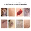 Tattoo Cover Up, 6 Pcs Waterproof Tattoo Cover Up Stickers, Ultra Thin Invisible Skin Tone Patches for Tattoos, Scars, and Birthmarks, Sweatproof Concealer view 2