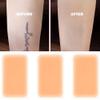 Tattoo Cover Up, 6 Pcs Waterproof Tattoo Cover Up Stickers, Ultra Thin Invisible Skin Tone Patches for Tattoos, Scars, and Birthmarks, Sweatproof Concealer view 3