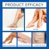 Varicose Veins Cream, Treatment of Varicose Veins with Blue Light Laser Treatment Pen, Varicose Veins Blue Light Therapy Kit with Laser (1) view 4