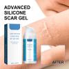Advanced Silicone Scar Gel,Effective Scar Cream,Reduces The Appearance of Both Old and New Scars from Burns, Injury, Acne, Stretch Marks (1) view 2