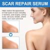 Advanced Silicone Scar Gel,Effective Scar Cream,Reduces The Appearance of Both Old and New Scars from Burns, Injury, Acne, Stretch Marks (1) view 4