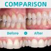 2PCS Gum Repair Gel Treatment,Gum Repair for Receding Gu-Ms,Teeth Re-Pair Gel,Gu-M Shield Therapy G-El,Teeth Brightening Essence Pen,Instant Treatment,Protect Oral Care,Deeply Cleaning,Fresh Breath view 2