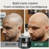 Bald Cream, Scalp Care Cream, After Shaving Care, Natural Anti-Shine Effect, Fights Skin Irritation and Shaving Burn, Skin Cream Men, Has a Matting Effect (1 Piece, 1) view 3