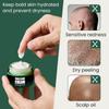 Bald Cream, Scalp Care Cream, After Shaving Care, Natural Anti-Shine Effect, Fights Skin Irritation and Shaving Burn, Skin Cream Men, Has a Matting Effect (1 Piece, 1) view 4