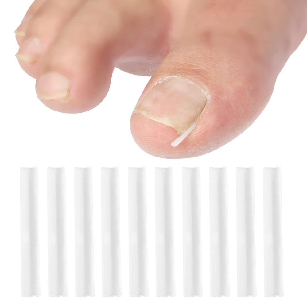 10Pcs White Ingrown Toenail Correction Strips Brace Kit, Nail Tools,Ingrown Toenail Corrector,Toenails Thick Pedicure Tool Toenail Straightener Strip for Men Women Foot Care Tool and Accessories