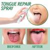 Tongue Repair Spray for Dryness& Bad Breath,Sore Tongue Relief,Oral Care Spray for Repairing White Tongue Coating,Fissured Tongue Relief Spray,Breath Freshener Moisturising Dry Mouth Relief Spray (2) view 2