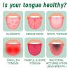 Tongue Repair Spray for Dryness& Bad Breath,Sore Tongue Relief,Oral Care Spray for Repairing White Tongue Coating,Fissured Tongue Relief Spray,Breath Freshener Moisturising Dry Mouth Relief Spray (2) view 3