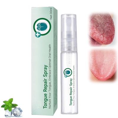 Tongue Repair Spray for Dryness& Bad Breath,Sore Tongue Relief,Oral Care Spray for Repairing White Tongue Coating,Fissured Tongue Relief Spray,Breath Freshener Moisturising Dry Mouth Relief Spray (1)