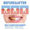 4PCS Gum Repair Gel, Gum Protect Repair Gel for Receding Gums, Mild Teeth Improvement, Oral Care Gels for Deep Cleaning & Fresh Breath view 2