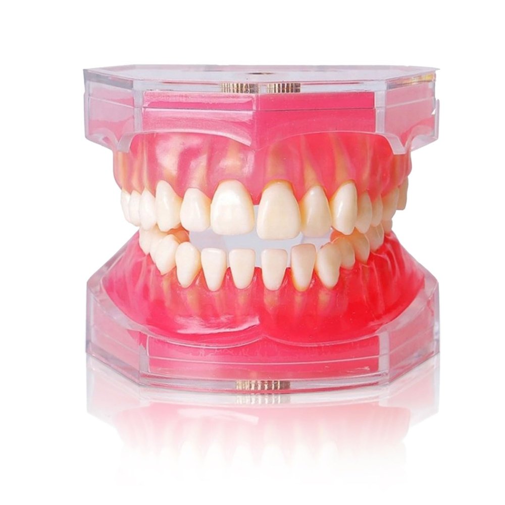 Dental Implant Teeth Model with Removable Resin Teeth & Soft Gum for Oral Surgeons, Dental Students Practice