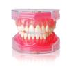 Dental Implant Teeth Model with Removable Resin Teeth & Soft Gum for Oral Surgeons, Dental Students Practice view 1