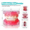Dental Implant Teeth Model with Removable Resin Teeth & Soft Gum for Oral Surgeons, Dental Students Practice view 3