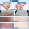 Terthon Herbal Antifungal Skin Cream: Treatment for Ringworm, Jock Itch, Athletes Foot & Fungal Skin Infections Natural, Fast-Acting Formula (20g (2 Pack)) view 2