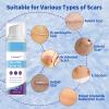 Silicone Scar Gel - Advanced Scar Treatment Gel for Old & New Scars - Scar Removal Cream for C-Section, Stretch Marks, Acne, Surgery & Keloid Bump - Smooth, Fade & Repair Skin view 3