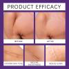 Silicone Scar Gel - Advanced Scar Treatment Gel for Old & New Scars - Scar Removal Cream for C-Section, Stretch Marks, Acne, Surgery & Keloid Bump - Smooth, Fade & Repair Skin view 4