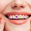 Duroecsain Kit, Extensive Set for Application, Replacement Temporary Repair Cosmetic Improvement Filling for Aesthetic Requirements view 3