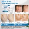 5 Packs Silicone Scar Sheets, Scar Removal Strips, Upgraded Waterproof Silicone Gel Tape Multipurpose Scar Patches for Women Men to Have a Better Skin Tone view 2