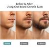 Beard Stimulating Balm, Extra-Strength Beard Stimulating Balm, Moisturizing and Non-Greasy, Moisturizing Treatment for All Men view 4