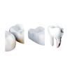 10PCS Brush Head for Removing Dental Calculus and Tartar,Compatible for Philips, HX3,6,8,9 Series Electric Toothbrush(White) view 2