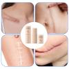 Scar Stick for Face - Moisturizing Silicone Face Scar Stick,Skin Care Products Soothing Repair Balm for Women Daily Men Daytime Nighttime Travel Sports Pre-Makeup Overnight Recovery view 4