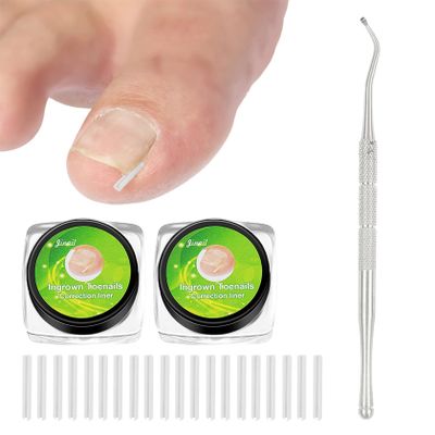101 Pcs Ingrown Toenail Set, Clear Plastic Ingrown Toenail Corrector with Nail Remover, Straightener Strips for Women Men Foot Care