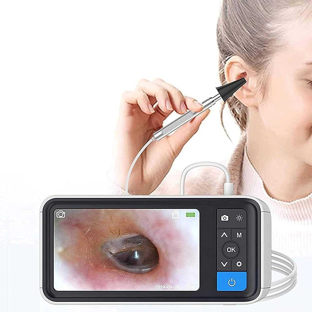 Digital Otoscope with 6 LED Lights and 4.5 Inch Screen - Rechargeable for Ear Wax Removal in Adults, Children, and Pets