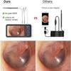Digital Otoscope with 6 LED Lights and 4.5 Inch Screen - Rechargeable for Ear Wax Removal in Adults, Children, and Pets view 3