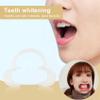 Agwuoetr 3pcs Autoclavable Dental Teeth Whitening Lip & Cheek Retractor Dentist Mouth Opener Repeat Use, S view 3