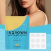 YNPQTDS Ingrown Hair, Pack of 9 Gentle Hair Removal Patches, Stickers for Scalp Care - For Men Women Armpits Legs Arms Beard Area Daily Overnight Home view 3
