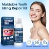 2Pcs Temporary Tooth Filling Repair Kit Moldable False Teeth Replacement with Dental Repair Beads, Easy to Fix Missing/Broken Teeth, with 3 Types of Dental Mirror Tools (2 Box) view 3