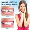 2Pcs Temporary Tooth Filling Repair Kit Moldable False Teeth Replacement with Dental Repair Beads, Easy to Fix Missing/Broken Teeth, with 3 Types of Dental Mirror Tools (2 Box) view 4
