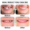 2 Pack of False Teeth for Men Women, Comfort Fit Snap on Veneers Teeth for Covering Missing Teeth, Temporary Whitening Top and Bottom Veneer Dentures view 4