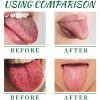 Tongue Repair Spray,Instant Dry Mouth Spray, Sore Tongue Relief,Moisturising Tongue Treatment and Fresh Breath,Fast Acting Mint Breath Spray for Adults (2pcs) view 2