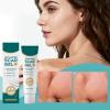 Scar Gel - 50 g Scuffs Care Product - Scratch Scars Care Cream - For Women Beauty Lovers Travelers Athletes Home Travel Daily Routine Knee Elbow Keloids view 3