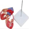 1:1 Human Heart Bypass Model Heart Bypass Surgery Model Detachable Human Anatomy Model of Heart Bypass for Medical Education Teaching Aids view 3