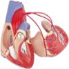 1:1 Human Heart Bypass Model Heart Bypass Surgery Model Detachable Human Anatomy Model of Heart Bypass for Medical Education Teaching Aids view 4