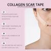 2pcs Silicone Scar Tape,Facial Fine Patch Concealer Patch Scar Roll, ReusableSmooths Fine Lines, Suitable for Scars, Burns and Acne, Tattoo Cover Up Patch for Tattoos Scars (1) view 3
