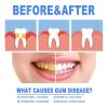 4Pcs Gums Repair Gel, 2025 Teeth Repair Gel, Natural Toothpaste Treatment Protect Gums & Oral Care, Deeply Cleaning RevitalizesGums, 4ml view 3