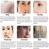 Professional Laser Tattoo Removal Machine for Eyebrow Lip Pigment Removal with Cooling System Beauty Salon Device view 3