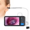 Digital Otoscope with 4.5" Screen, 1080p Ear Camera, Ear Wax Removal Tool, 32GB Card for Children and Adults view 1