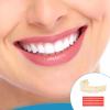 2 PCS Denture Repair Kit Moldable False Teeth Top and Bottom with 14PCS Red Wax Tablets DIY Resin Denture Kit for Men and Women with Bad Teeth to Repair Missing Teeth Teaching Mold view 4