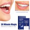 56 Pcs Teeth Whitening Strips, Whitening Strips,Anti-allergenic Tooth Stain Treatment,Safe Non-Slip Dry Strip,Decompose pigments,Fast Results,in 30 Minutes view 2
